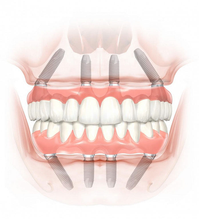 Dentist is checking up a patient with an ortodental system