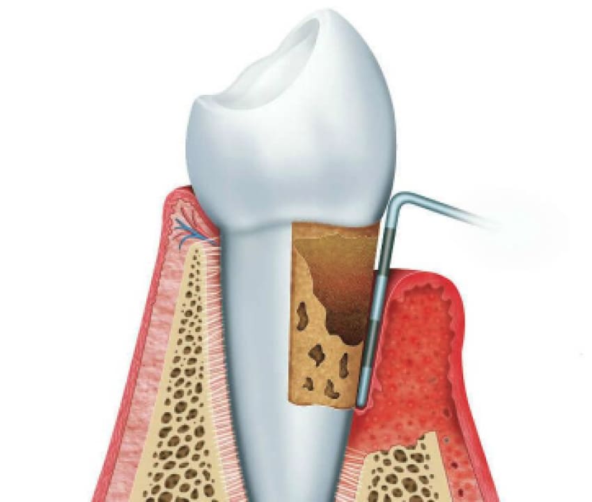 Dentist is checking up a patient with an ortodental system