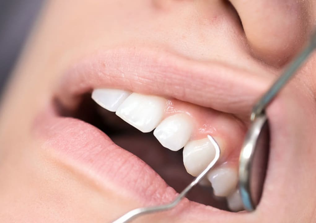 Dentist is checking up a patient with an ortodental system