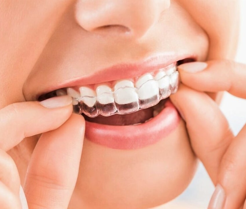 Dentist is checking up a patient with an ortodental system