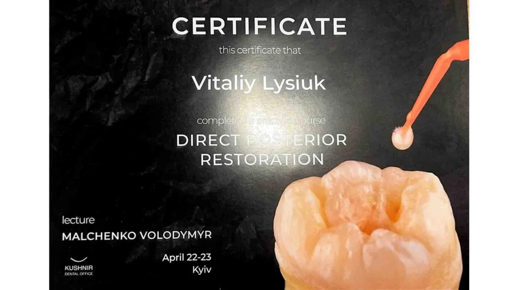 Сертифікат Віталія Лисюка про завершення курсу Direct Posterior Restoration із реставрації жувальних зубів
